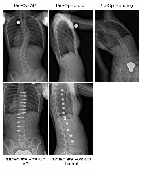 case1